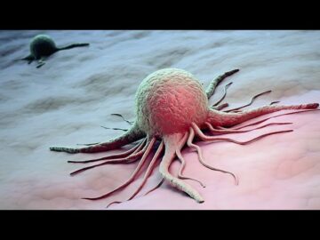 [ID: 1f_8tzk2dzg] Youtube Automatic