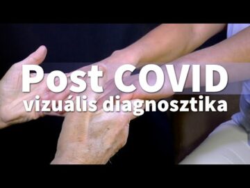 [ID: Cd36TNC71Z8] Youtube Automatic